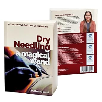 Dry needling
